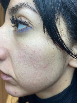 Процедуры по косметологии в студии красоты «Luciana Bravo» со скидкой до 44%