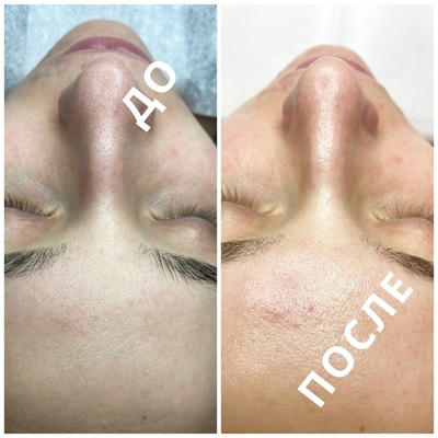 Косметологические услуги в салоне красоты «Pion» со скидкой!