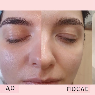 Услуги эстетической косметологии со скидкой до 55% от «NPraim»!