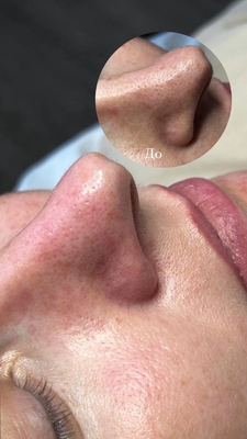 Косметологические услуги в студии «FaceLab Space» со скидкой до 55%! Косметологические услуги в студии «FaceLab Space» со скидкой до 55%!