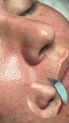 Косметологические услуги в студии «FaceLab Space» со скидкой до 55%! Косметологические услуги в студии «FaceLab Space» со скидкой до 55%!