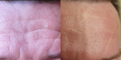 Услуги эстетической косметологии со скидкой до 55% от «NPraim»!