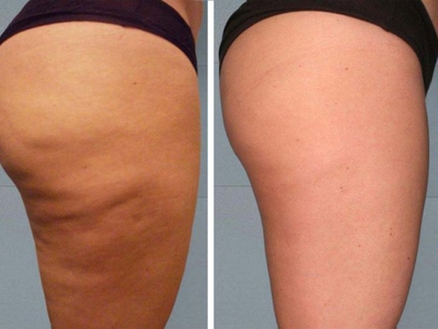 Будьте прекрасны! Идеальная фигура для Вас в салоне красоты со скидками до 57% «ELVIRA_BEAUTY_LOUNGE»!