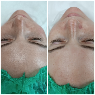 Косметологические услуги в салоне красоты «Pion» со скидкой!