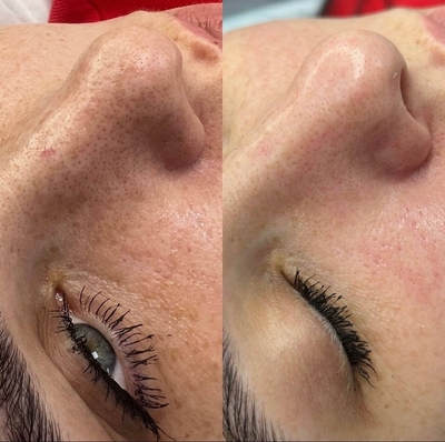 Косметологические услуги в салоне красоты «Pion» со скидкой!