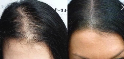 Будь ярче благодаря студии красоты «Goldi» со скидкой до 85%!