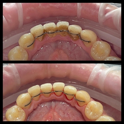 Стоматологическая клиника «Маг-Дент-Наири» дарит скидку до 71%! Стоматологическая клиника «Маг-Дент-Наири» дарит скидку до 71%!