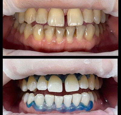 Улыбайтесь чаще! Стоматология «SMILE FOR YOU» дарит скидку до 40%