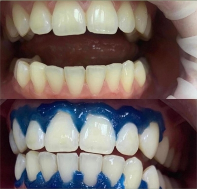 Стоматологическая клиника «Маг-Дент-Наири» дарит скидку до 71%! Стоматологическая клиника «Маг-Дент-Наири» дарит скидку до 71%!