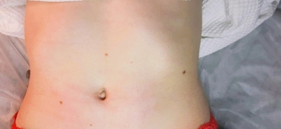 Скидки до 47% на аппаратное похудение в салоне красоты «Красивые люди»!