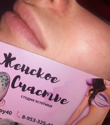 Лазерная эпиляция со скидкой до 50% в салоне «Женское счастье»!