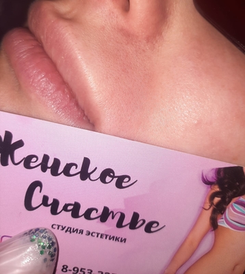 Лазерная эпиляция со скидкой до 50% в салоне «Женское счастье»!