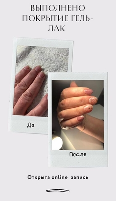 Пробуди энергию красоты вместе с салоном «White lab» со скидками до 59%! Пробуди энергию красоты вместе с салоном «White lab» со скидками до 59%!