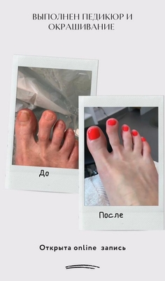 Пробуди энергию красоты вместе с салоном «White lab» со скидками до 59%! Пробуди энергию красоты вместе с салоном «White lab» со скидками до 59%!