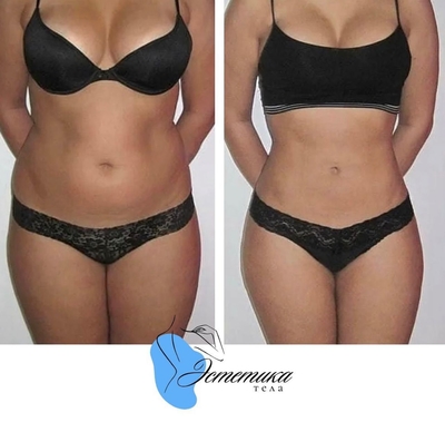 Эстетика тела