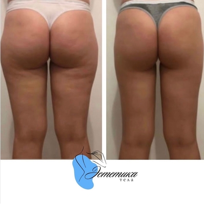 Эстетика тела