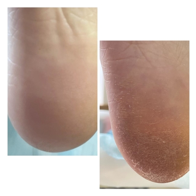 Smart-педикюр и маникюр в салоне «Krasotka.prof71» со скидкой 60%!