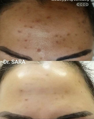 Пора побаловать себя! Услуги профессионального косметолога со скидкой до 30% в салоне красоты «Вдохновение»! Пора побаловать себя! Услуги профессионального косметолога со скидкой до 30% в салоне красоты «Вдохновение»!