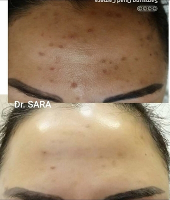 Пора побаловать себя! Услуги профессионального косметолога со скидкой до 30% в салоне красоты «Вдохновение»! Пора побаловать себя! Услуги профессионального косметолога со скидкой до 30% в салоне красоты «Вдохновение»!