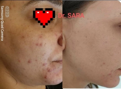 Пора побаловать себя! Услуги профессионального косметолога со скидкой до 30% в салоне красоты «Вдохновение»! Пора побаловать себя! Услуги профессионального косметолога со скидкой до 30% в салоне красоты «Вдохновение»!