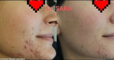 Пора побаловать себя! Услуги профессионального косметолога со скидкой до 30% в салоне красоты «Вдохновение»! Пора побаловать себя! Услуги профессионального косметолога со скидкой до 30% в салоне красоты «Вдохновение»!