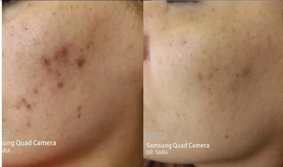 Пора побаловать себя! Услуги профессионального косметолога со скидкой до 30% в салоне красоты «Вдохновение»! Пора побаловать себя! Услуги профессионального косметолога со скидкой до 30% в салоне красоты «Вдохновение»!