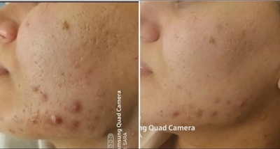 Пора побаловать себя! Услуги профессионального косметолога со скидкой до 30% в салоне красоты «Вдохновение»! Пора побаловать себя! Услуги профессионального косметолога со скидкой до 30% в салоне красоты «Вдохновение»!