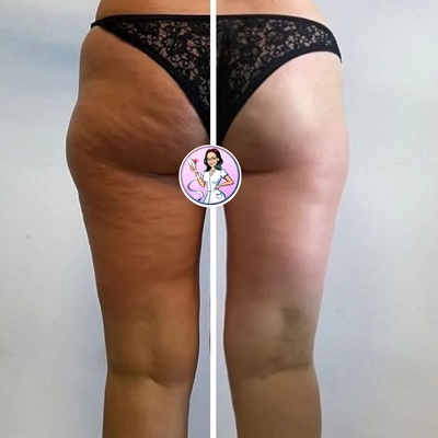 Женское счастье, похудение