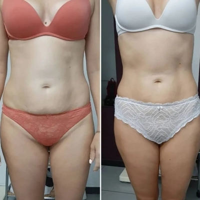 Женское счастье, похудение