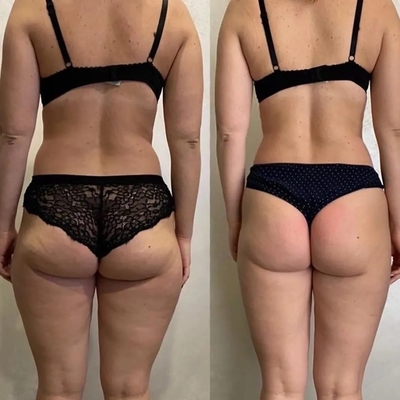 Женское счастье, похудение