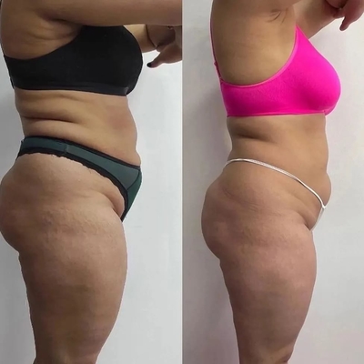 Женское счастье, похудение