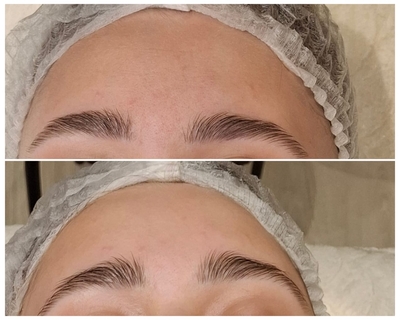 «Lady in Red»: косметологические процедуры со скидкой до 52% «Lady in Red»: косметологические процедуры со скидкой до 52%