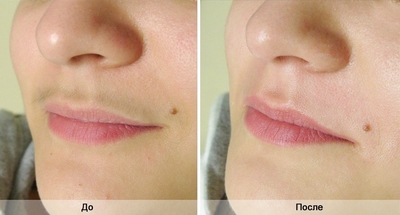 Студия депиляции и архитектуры бровей «BRENDA» со скидкой до 67%