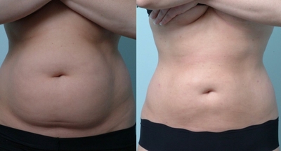 Будьте прекрасны! Идеальная фигура для Вас в салоне красоты со скидками до 57% «ELVIRA_BEAUTY_LOUNGE»!